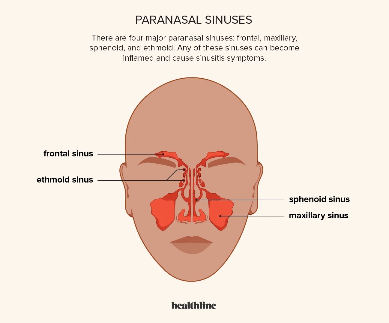 Ways to relieve sinus headache instantly