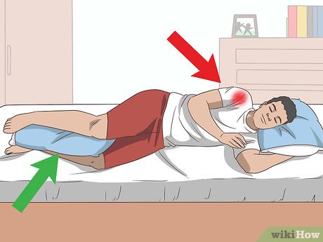 Effective Ways to Relieve Rotator Cuff Pain at Night: Discover Proven Techniques for Better Sleep in 2025